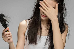 治疗脱发的妙招