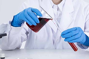 女人血稠吃什么食物好-血稠吃什么蔬菜降血脂最好