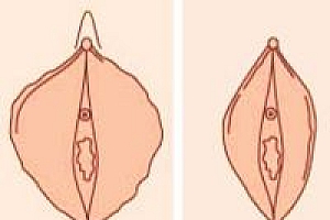 女人阴部形状有哪几种?