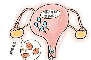 自查!卵巢功能低下的6大表现,你有没有呢?