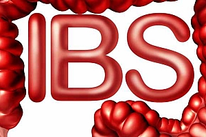 内痔如何分型及分期