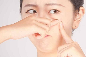 脸部痤疮要用温水洗脸吗-为什么青春痘患者要用温水洗脸