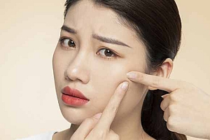 怎样预防青春痘的方法-化妆品青春痘该如何防治