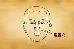 穴位针灸防治过敏性鼻炎包括哪些方法-过敏性鼻炎针灸扎哪里