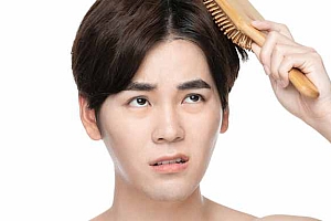 男性脱发标准-男性脱发的症状